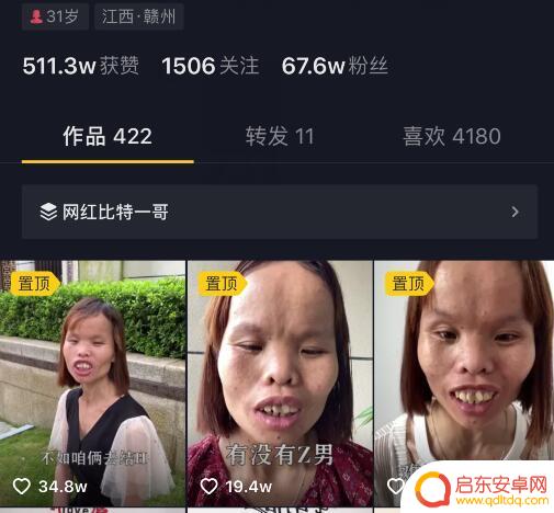 抖音丑女亲吻图片(抖音丑女亲吻图片大全)