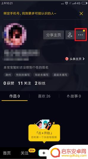 怎么移除抖音授权(怎么移除抖音授权管理)