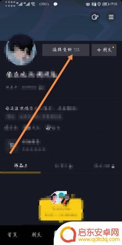 抖音怎样才能改抖音名字(抖音怎样才能改抖音名字呢)