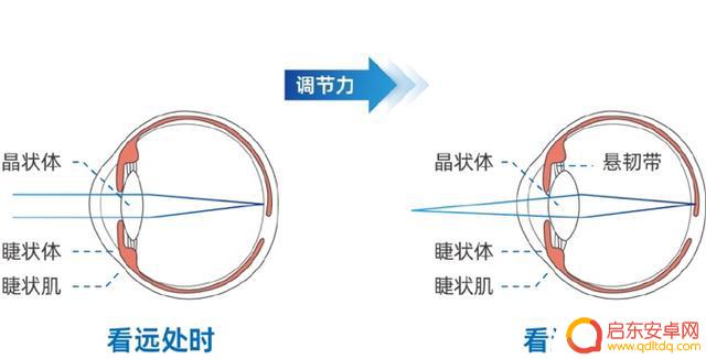 小心!看手机会导致“视频终端综合征”