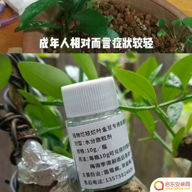 抖音细菌以前视频(抖音细菌之前的视频)