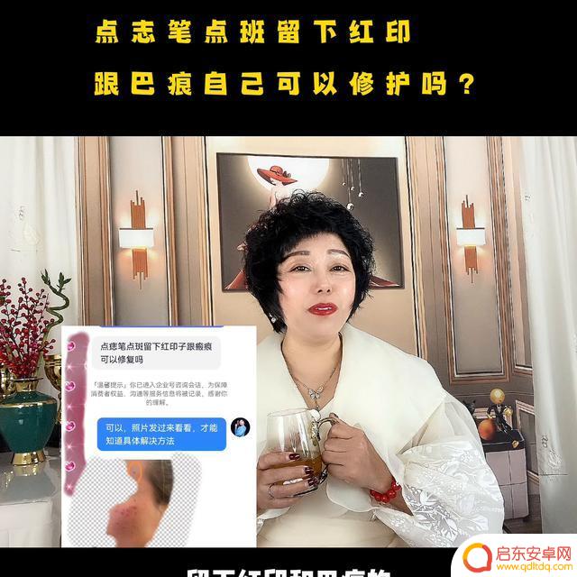 抖音里面疤痕修复(抖音疤痕修复是真的吗)