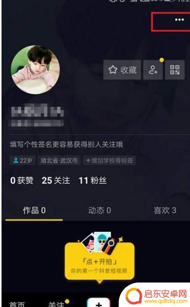 禁止自动打开抖音(禁止自动打开抖音怎么设置)