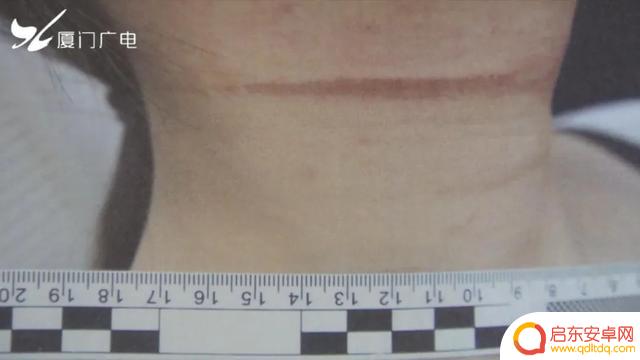 厦门抖音女主播事件(厦门抖音女主播事件真相)