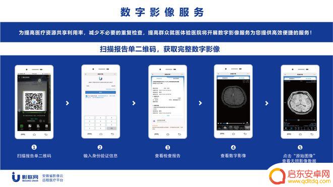 手机上怎么查磁共振报告单 蚌医二附院无胶片化