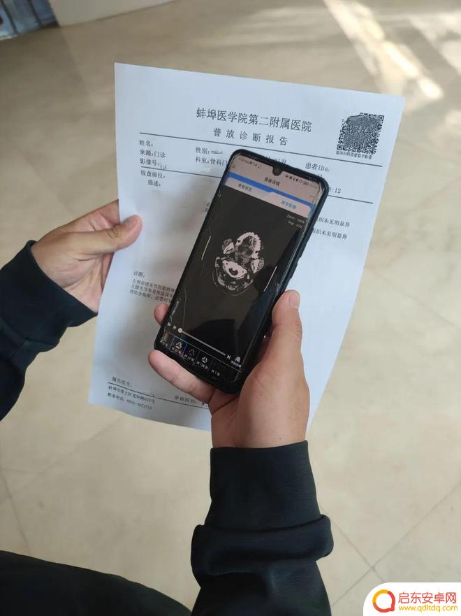 手机上怎么查磁共振报告单 蚌医二附院无胶片化