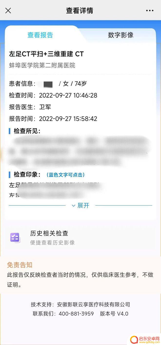 手机上怎么查磁共振报告单 蚌医二附院无胶片化