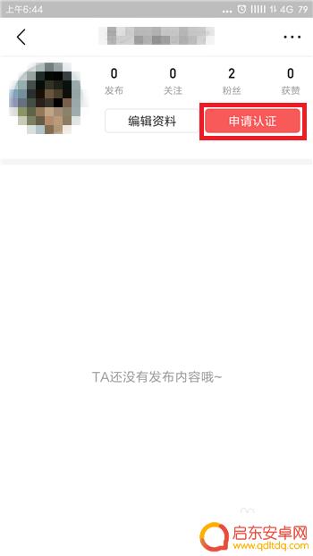 头条怎么与手机绑定 今日头条账号如何绑定手机号