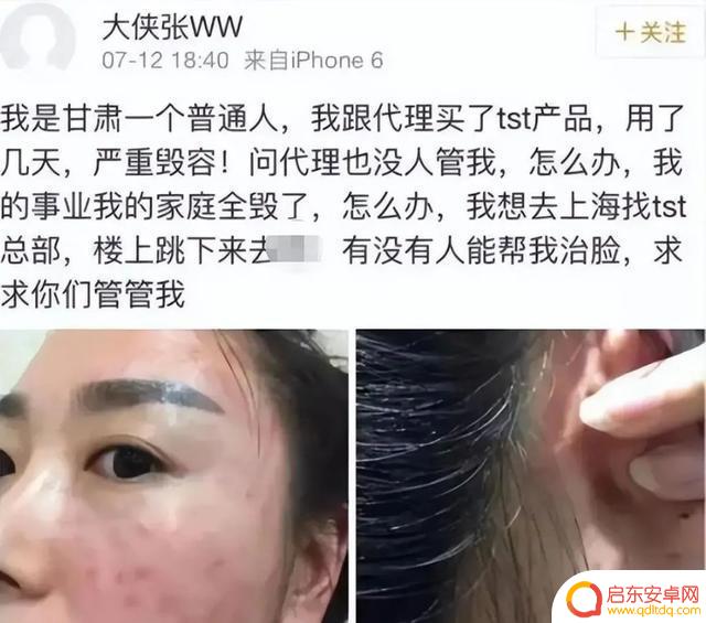 张庭林瑞阳做饭抖音(张庭林瑞阳抖音视频)